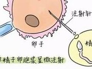 女性年纪大做试管必须降调吗？先了解降调的优势和风险！